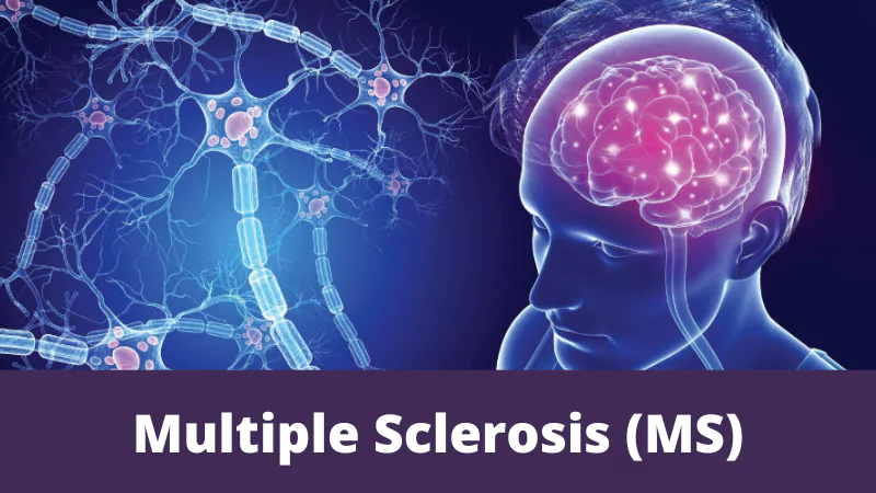 Multiple Sclerosis (MS)