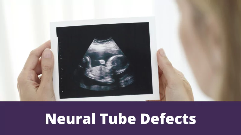 Neural tube defects