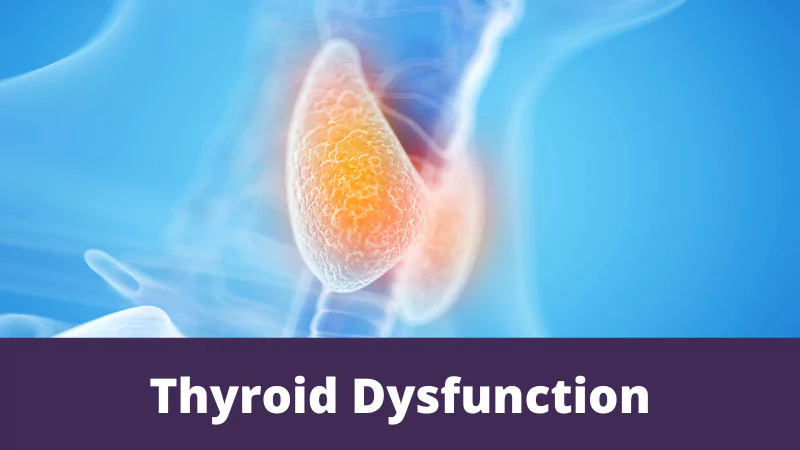 Thyroid Dysfunction